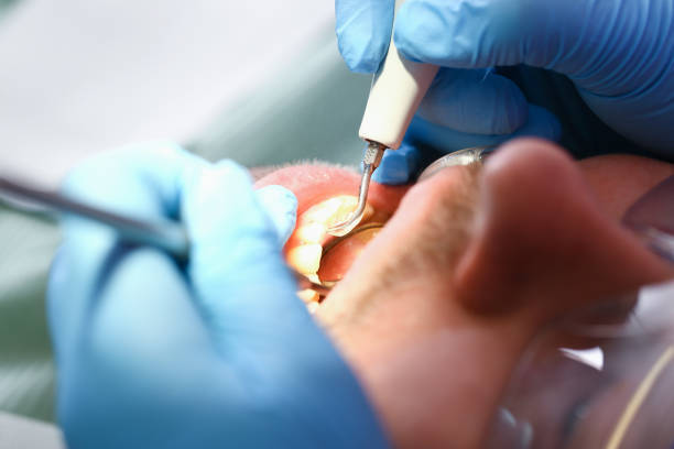 Best Emergency Treatment for Toothache in West Frankfort, IL
