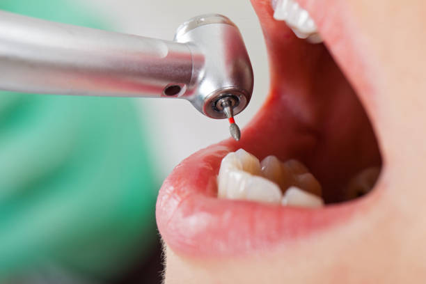 Best Emergency Treatment for Toothache in West Frankfort, IL